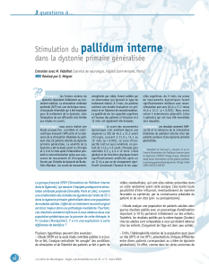 pallidum interne Stimulation du dans la dystonie primaire généralisée 3