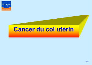 Dépistage du cancer du col utérin - Ligue contre le Cancer