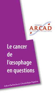 Le cancer de l`œsophage en questions