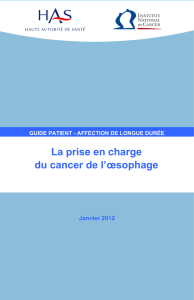 La prise en charge du cancer de l`œsophage