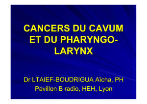 cancers du cavum et du pharyngo- larynx