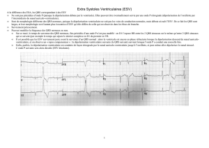 Extra Systoles Ventriculaires (ESV)