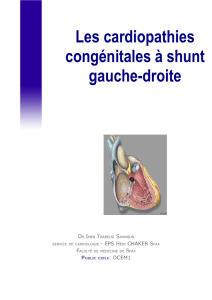 Les cardiopathies congénitales à shunt gauche-droite