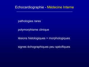 myocarde - echowebline