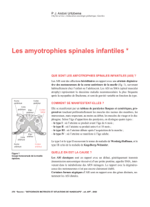 Les amyotrophies spinales infantiles - Moteurline