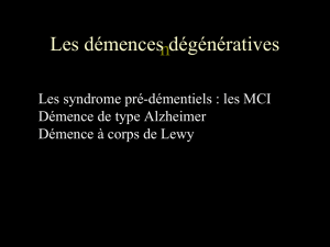 Corps de Lewy