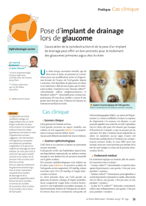 L.BOUHANNA - Pose d`implant de drainage lors de glaucome