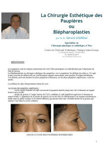 BLEPHAROPLASTIES ou - Chirurgie esthétique à Nice