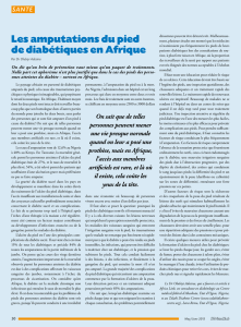 Les amputations du pied de diabétiques en Afrique