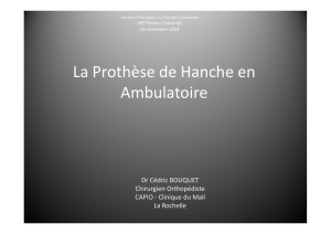 La prothèse de hanche en ambulatoire