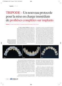 TRIPODE – Un nouveau protocole pour la mise en charge