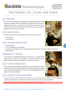 TRAITEMENT DE L`ACNE PAR LASER