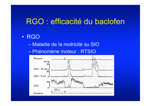 RGO : efficacité du baclofen