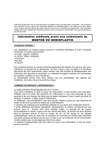 Information médicale avant une ostéotomie du MENTON OU