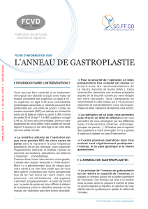 Fiche information anneau de gastroplastie ( PDF )