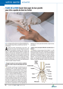 votre santé actualité Accidents - Service de chirurgie de la main, du