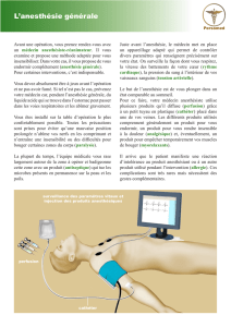 L`anesthésie générale