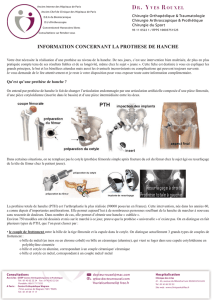 information concernant la prothese de hanche