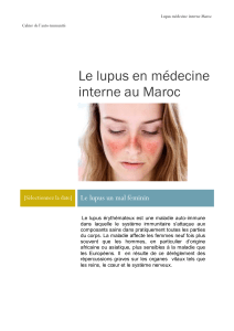 Le lupus en médecine interne au Maroc