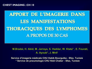 APPORT DE L’IMAGERIE DANS LES MANIFESTATIONS THORACIQUES DES LYMPHOMES