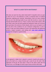 What is laser teeth whitening