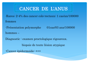 CANCER DE L’ANUS 2020