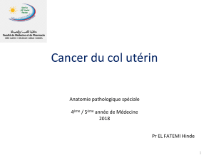 cancer du col utérin (anatomie pathologique)