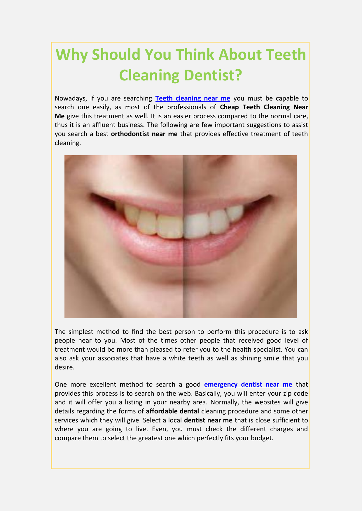 Why Should You Think About Teeth Cleaning Dentist