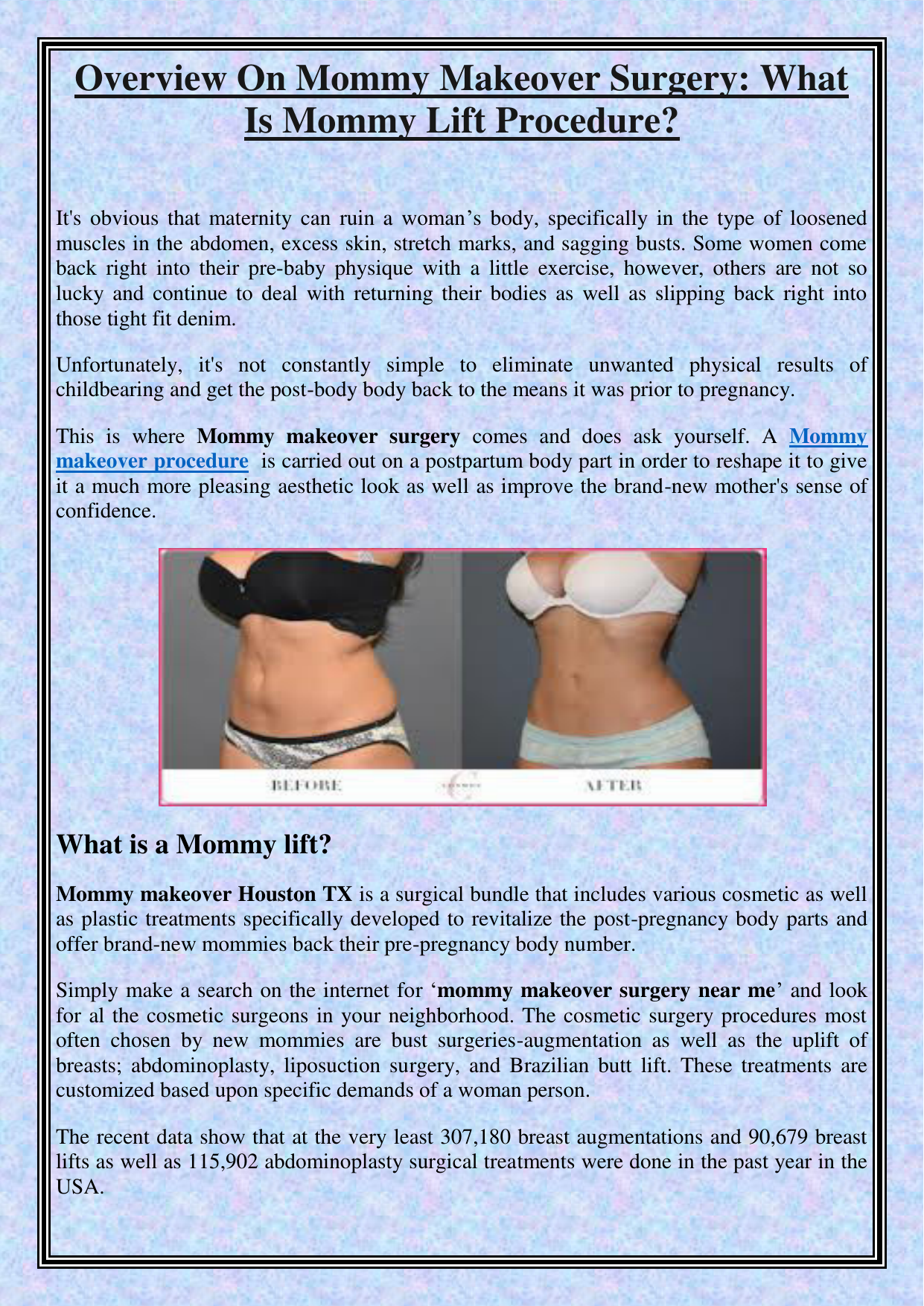 Overview On Mommy Makeover Surgery What Is Mommy Lift Procedure 