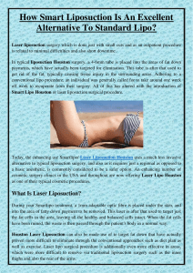 How Smart Liposuction Is An Excellent Alternative To Standard Lipo