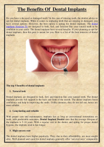 The Benefits Of Dental Implants