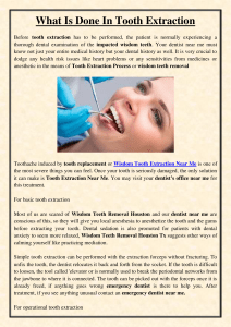 What Is Done In Tooth Extraction