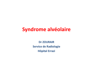 Syndrome alvéolaire