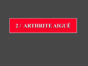 2- Arthrite aigue