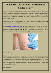 What Are The Various Treatments of Spider Veins