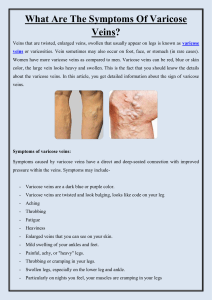 What are the Symptoms of Varicose Veins