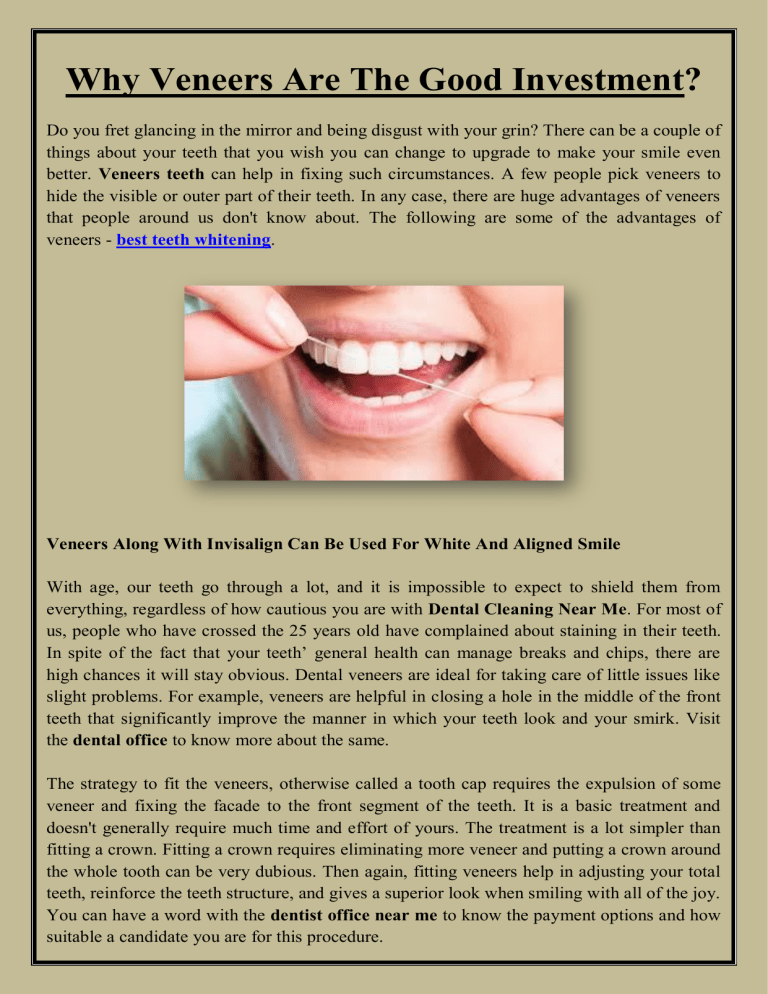 Why Veneers Are The Good Investment