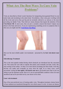 What Are The Best Ways To Cure Vein Problems
