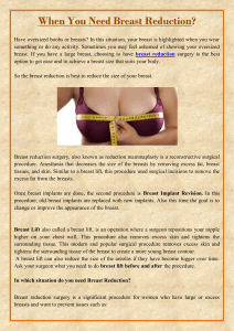When You Need Breast Reduction