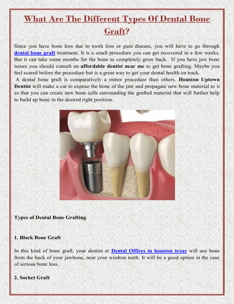 What Are The Different Types Of Dental Bone Graft
