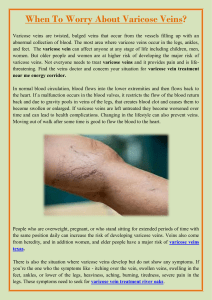 When To Worry About Varicose Veins