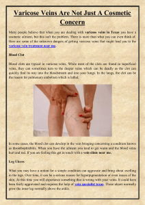Varicose Veins Are Not Just A Cosmetic Concern