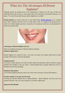 What Are The Advantages Of Dental Implants