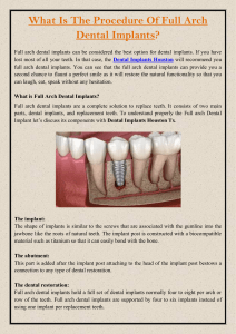 What Is The Procedure Of Full Arch Dental Implants