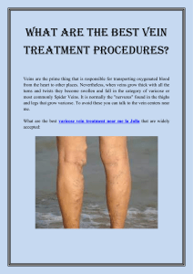 What are the best vein treatment procedures