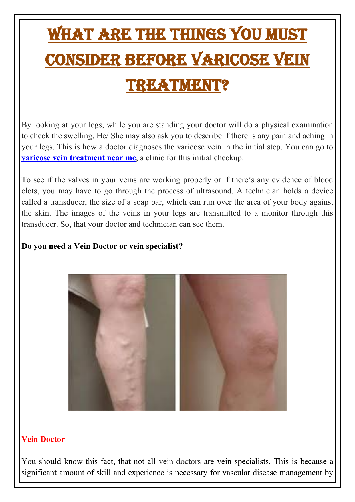 varicose veins treatment training
