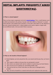 Dental implants Frequently Asked Questions(FAQ)