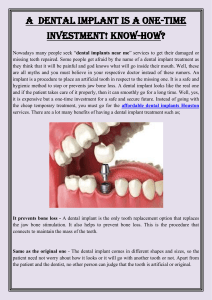A  Dental Implant Is a One-Time Investment! Know-How