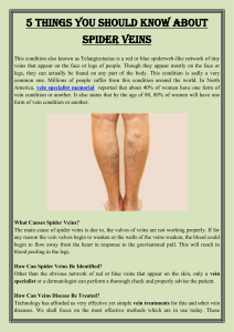 5 Things you should know about spider veins