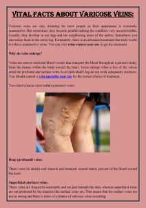 Vital Facts About Varicose Veins